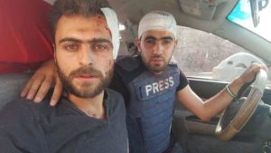 الناشطين هادي العبد الله وخالد العيسى بعد إصابتهما قبل أيام جراء قصف بالبراميل المتفجرة في حلب